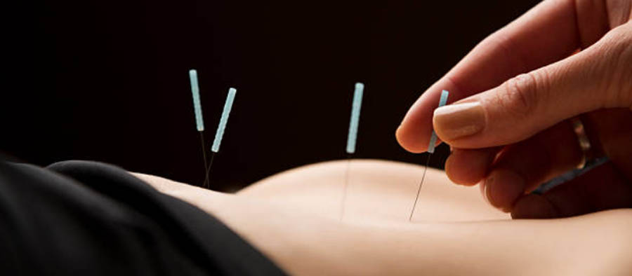 Roots of Wellness Acupuncture